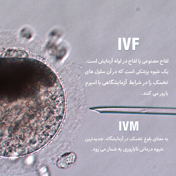 درمان ناباروری با IVF-IVM درمان ناباروری با IVF-IVM