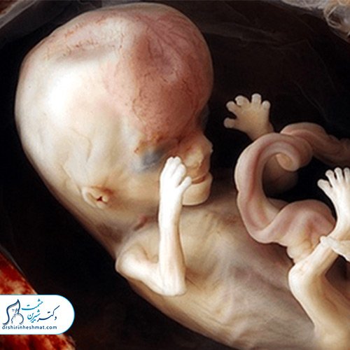 جنین_تشکیل-شده_مجموعه_دکتر_شیرین_حشمت جنین_تشکیل-شده_مجموعه_دکتر_شیرین_حشمت