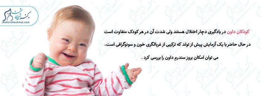 کودکان سندرم دان کودکان سندرم دان