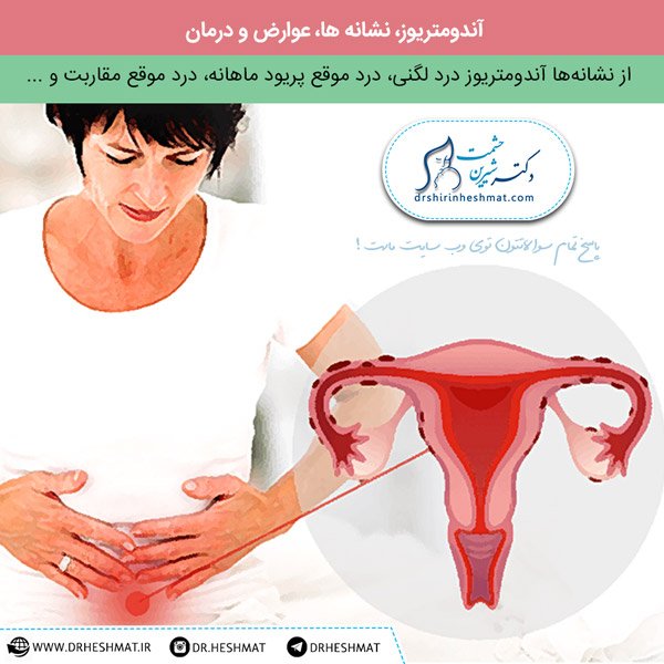آندومتریوز، نشانه ها و درمان آندومتریوز،
