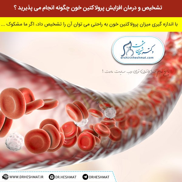 تشخیص و درمان افزایش پرولاکتین خون و اثرات آن روی بانوان پرولاکتین خون