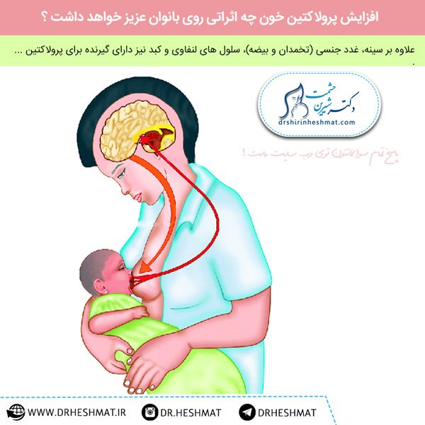 افزایش پرولاکتین خون و اثرات آن روی بانوان ،مجموعه دکتر حشمت افزایش پرولاکتین خون و اثرات آن روی بانوان ،مجموعه دکتر حشمت